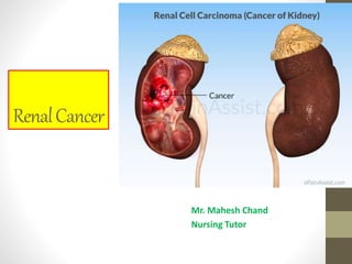 RenalCancer
Mr. Mahesh Chand
Nursing Tutor
 