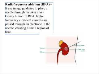 Radiofrequency ablation (RFA) -
It use image guidance to place a
needle through the skin into a
kidney tumor. In RFA, high-
frequency electrical currents are
passed through an electrode in the
needle, creating a small region of
heat.
 
