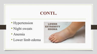 CONTI..
• Hypertension
• Night sweats
• Anemia
• Lower limb edema
 