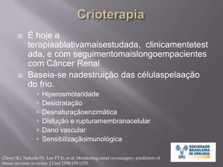 TécnicasMinimamenteInvasivasNefrectomiaParcialLaparoscópicaNefrectomiaParcial “Hand-Assisted”TerapiasAblativas:CrioterapiaRadio-frequênciaHIFU (High Intensity Focused Ultrasound)Micro-ondas