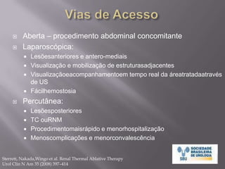 Terapias Ablativas no Câncer RenalObjetivos:Reprodução dos resultadosoncológicos da nefrectomiaparcial.Diminuição de complicações, hospitalização e convalescênciaApenas dados de curto e médioprazoTerapiasAblativas:CrioterapiaRadio-frequênciaHIFU (High Intensity Focused Ultrasound)Micro-ondas, Radio-cirurgia