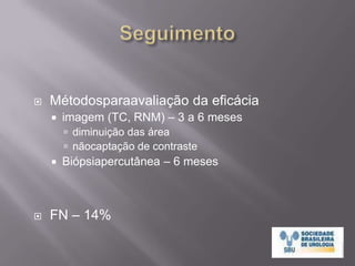 Vias de AcessoAberta – procedimento abdominal concomitanteLaparoscópica:Lesõesanteriores e antero-mediaisVisualização e mobilização de estruturasadjacentesVisualizaçãoeacompanhamentoem tempo real da áreatratadaatravés de USFácilhemostosiaPercutânea:LesõesposterioresTC ouRNMProcedimentomaisrápido e menorhospitalizaçãoMenoscomplicações e menorconvalescênciaSterrett, Nakada,Wingo et al. Renal Thermal Ablative TherapyUrol Clin N Am 35 (2008) 397–414