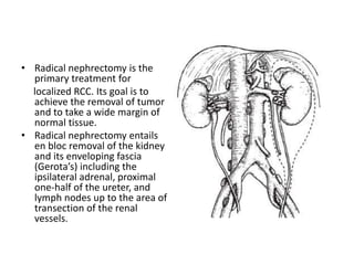 • Radical nephrectomy is the
primary treatment for
localized RCC. Its goal is to
achieve the removal of tumor
and to take a wide margin of
normal tissue.
• Radical nephrectomy entails
en bloc removal of the kidney
and its enveloping fascia
(Gerota’s) including the
ipsilateral adrenal, proximal
one-half of the ureter, and
lymph nodes up to the area of
transection of the renal
vessels.
 