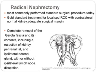 Radical Nephrectomy
 most commonly performed standard surgical procedure today
 Gold standard treatment for localised RCC with contralateral
normal kidney,adequate surgical margin
 Complete removal of the
Gerota fascia and its
contents, including a
resection of kidney,
perirenal fat, and
ipsilateral adrenal
gland, with or without
ipsilateral lymph node
dissection.
 