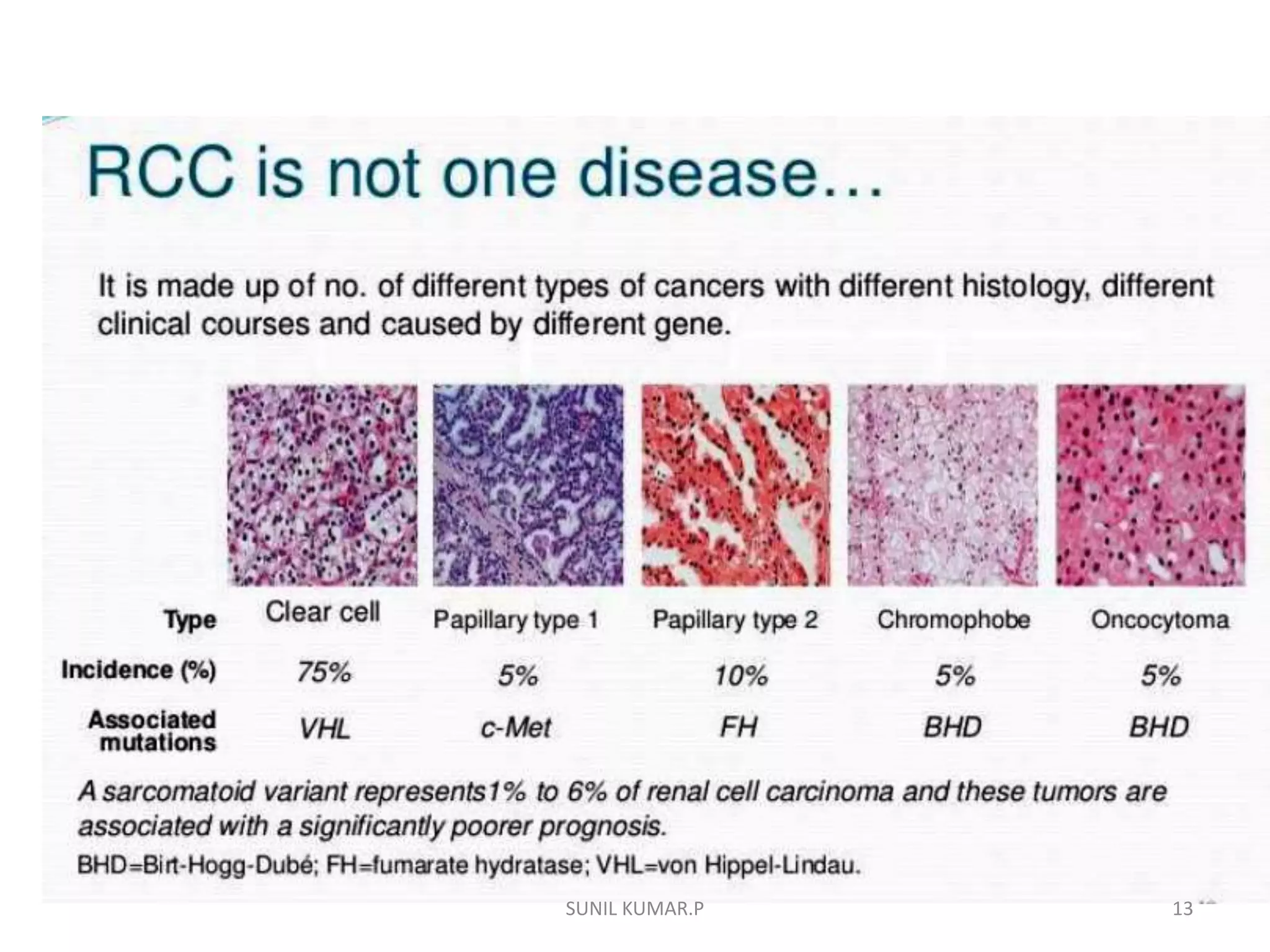 Renal cell carcinoma | PPTX