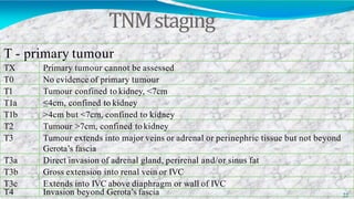 TNMstaging
22
T - primary tumour
TX Primary tumour cannot be assessed
T0 No evidence of primary tumour
T1 Tumour confined to kidney, <7cm
T1a ≤4cm, confined to kidney
T1b >4cm but <7cm, confined to kidney
T2 Tumour >7cm, confined to kidney
T3 Tumour extends into major veins or adrenal or perinephric tissue but not beyond
Gerota’s fascia
T3a Direct invasion of adrenal gland, perirenal and/or sinus fat
T3b Gross extension into renal vein or IVC
T3c Extends into IVC above diaphragm or wall of IVC
T4 Invasion beyond Gerota’s fascia
 
