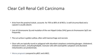 RENAL CELL CARCINOMA MANGMENT NEW RECENT ADVANCE | PPTX