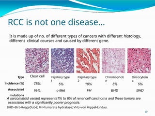 RENAL CELL CARCINOMA PATHOGENESIS AND CLASSIFICATION | PPTX
