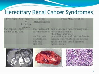 RENAL CELL CARCINOMA PATHOGENESIS AND CLASSIFICATION | PPTX