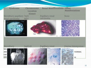 RENAL CELL CARCINOMA PATHOGENESIS AND CLASSIFICATION | PPTX