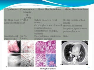 RENAL CELL CARCINOMA PATHOGENESIS AND CLASSIFICATION | PPTX