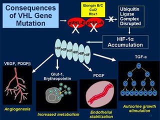 RENAL CELL CARCINOMA PATHOGENESIS AND CLASSIFICATION | PPTX