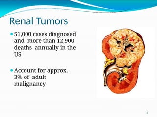 RENAL CELL CARCINOMA PATHOGENESIS AND CLASSIFICATION | PPTX