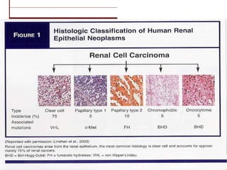 Renal Cell Carcinoma Diagnosis And Management | PPT