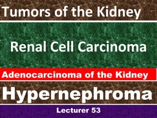 Renal Cell Carcinoma
Lecturer 53
Tumors of the Kidney
Adenocarcinoma of the Kidney
Hypernephroma
 