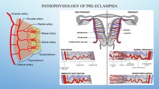 Renal Changes in Pregnancy and Pathophysiology of Preeclampsia .pptx