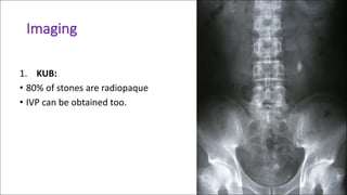 Renal and Ureteric Colic (Concise Emergency Evaluation) | PDF