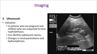 Renal and Ureteric Colic (Concise Emergency Evaluation) | PDF