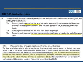 2017 TNM classification system
 