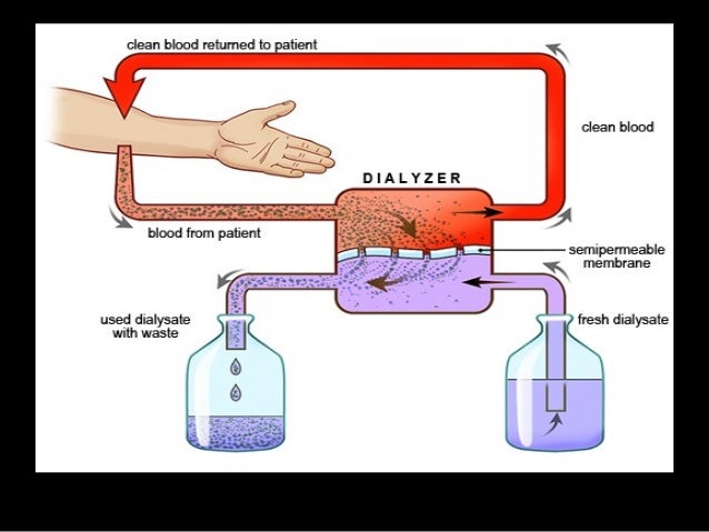 renal dialysis dialysate