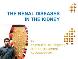 THE RENAL DISEASES
      IN THE KIDNEY



        BY
        PRAYTHIESH BRUCE(CRRI)
        DEPT OF OBG,SMIMS
        KULASEKHARAM
 