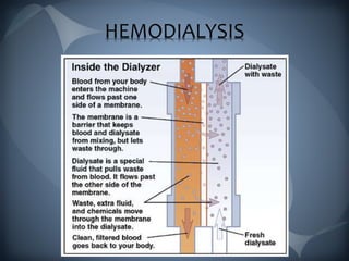 HEMODIALYSIS
 