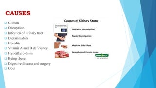 CAUSES
 Climate
 Occupation
 Infection of urinary tract
 Dietary habits
 Heredity
 Vitamin A and B deficiency
 Hyperthyroidism
 Being obese
 Digestive disease and surgery
 Gout
 