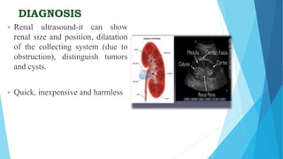 DIAGNOSIS
 Renal ultrasound-it can show
renal size and position, dilatation
of the collecting system (due to
obstruction), distinguish tumors
and cysts.
 Quick, inexpensive and harmless
 