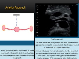 Anterior Approach
 