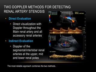 TWO DOPPLER METHODS FOR DETECTING
RENAL ARTERY STENOSIS
• Direct Evaluation
• Direct visualization with
Doppler throughout the
Main renal artery and all
accessory renal arteries
• Indirect Evaluation
• Doppler of the
segmental/interlobar renal
arteries at the upper, mid
and lower renal poles
Two Doppler Methods for Detecting
Renal Artery Stenosis
• Direct Evaluation
– Direct visualization
with Doppler
throughout the Main
renal artery and all
accessory renal
arteries
• Indirect Evaluation
– Doppler of the
segmental/interlobar
renal arteries at the
upper, mid and lower
renal poles
The most reliable approach combines the two methods.
 