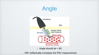 Angle
Angle should be < 60.
>60o artifactually increases the PSV measurement.
 