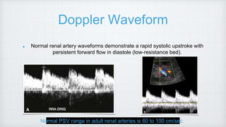 Doppler Waveform
Normal renal artery waveforms demonstrate a rapid systolic upstroke with
persistent forward flow in diastole (low-resistance bed).
Normal PSV range in adult renal arteries is 60 to 100 cm/sec.
 
