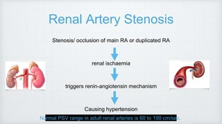 Renal Artery Stenosis
Stenosis/ occlusion of main RA or duplicated RA
renal ischaemia
triggers renin-angiotensin mechanism
Causing hypertension
Normal PSV range in adult renal arteries is 60 to 100 cm/sec.
 