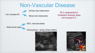 • U/L increase RI
• Solid renal mass
Urinary tract obstruction
Renal vein obstruction
RCC -neovascularity
Oncocytoma - spoke wheel pattern
RI in segmental or
intralobar arteries does
not exceed 0.7.
Non-Vascular Disease
 