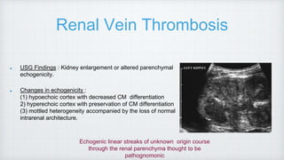 Renal Vein Thrombosis
USG Findings : Kidney enlargement or altered parenchymal
echogenicity.
Changes in echogenicity :
(1) hypoechoic cortex with decreased CM differentiation
2) hyperechoic cortex with preservation of CM differentiation
(3) mottled heterogeneity accompanied by the loss of normal
intrarenal architecture.
Echogenic linear streaks of unknown origin course
through the renal parenchyma thought to be
pathognomonic
 
