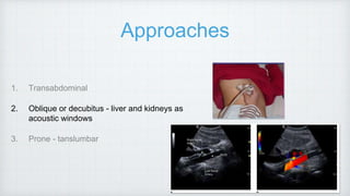 Approaches
1. Transabdominal
2. Oblique or decubitus - liver and kidneys as
acoustic windows
3. Prone - tanslumbar
 