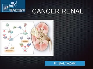 CANCER RENAL
F1 BALTAZAR
 