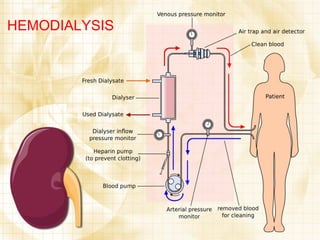 HEMODIALYSIS 