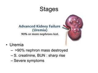 Stages Uremia >90% nephron mass destroyed S. creatinine, BUN : sharp rise Severe symptoms 