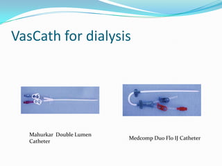 VasCath for dialysisMahurkar  Double Lumen CatheterMedcomp Duo Flo IJ Catheter