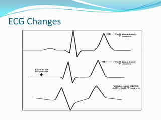 ECG Changes 