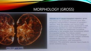 MORPHOLOGY (GROSS)
 
