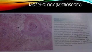 MORPHOLOGY (MICROSCOPY)
 