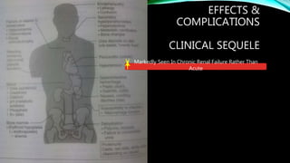 EFFECTS &
COMPLICATIONS
CLINICAL SEQUELE
Markedly Seen In Chronic Renal Failure Rather Than
Acute
 