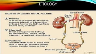 ETIOLOGY
 
