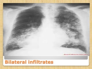 Renal failure case presentation | PPTX