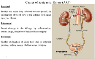 Causes of acute renal failure (ARF)
Prerenal
Sudden and sever drop in blood pressure (shock) or
interruption of blood flow to the kidneys from sever
injury or illness
Intrarenal
Direct damage to the kidneys by inflammation,
toxins, drugs, infection or reduced blood supply
Postrenal
Sudden obstruction of urine flow due to enlarged
prostate, kidney stones, bladder tumor or injury
8
 
