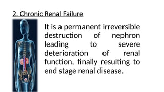 2. Chronic Renal Failure
It is a permanent irreversible
destruction of nephron
leading to severe
deterioration of renal
function, finally resulting to
end stage renal disease.
 