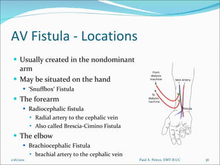 AV Fistula - Locations Usually created in the nondominant arm May be situated on the hand ‘ Snuffbox‘ Fistula The forearm Radiocephalic fistula Radial artery to the cephalic vein Also called Brescia-Cimino Fistula The elbow Brachiocephalic Fistula brachial artery to the cephalic vein Paul A. Peirce, EMT-B I/C 1/16/2011 