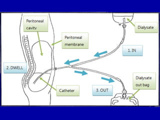 Renal func & dysfunc may 2016 | PPT